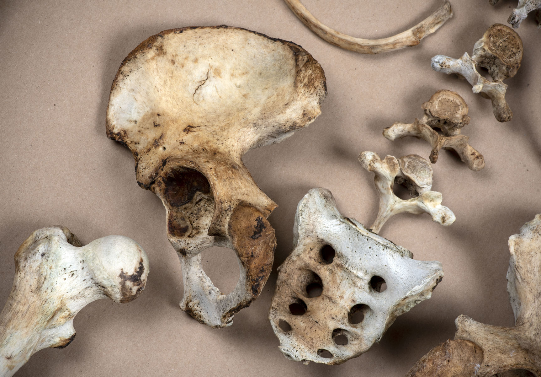 Unidentified remains